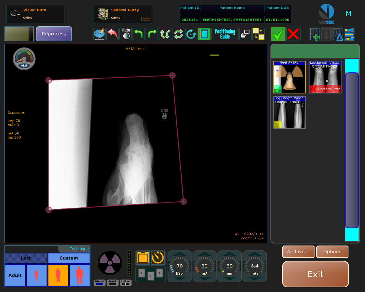 An interface designed for the convenience of X-ray technicians.